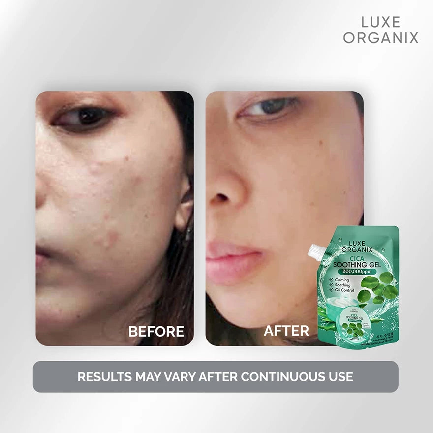 Luxe Organix Cica Soothing Gel 100ml