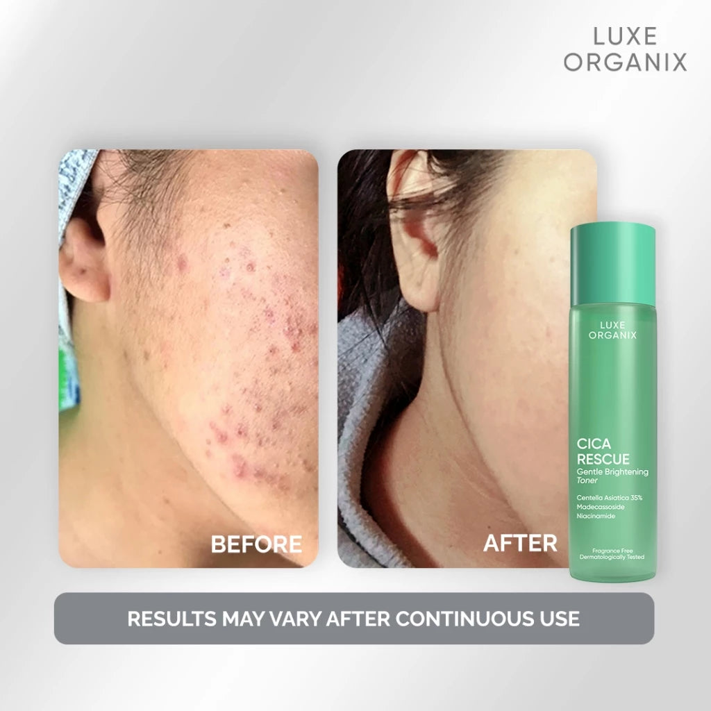 Luxe Organix Cica Rescue Gentle Brightening Toner 150ml