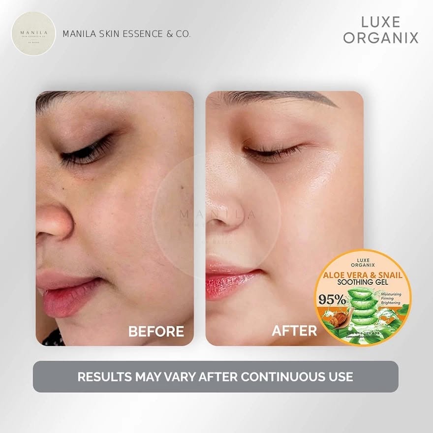 Luxe Organix Aloe Vera & Snail Soothing Gel 300ml