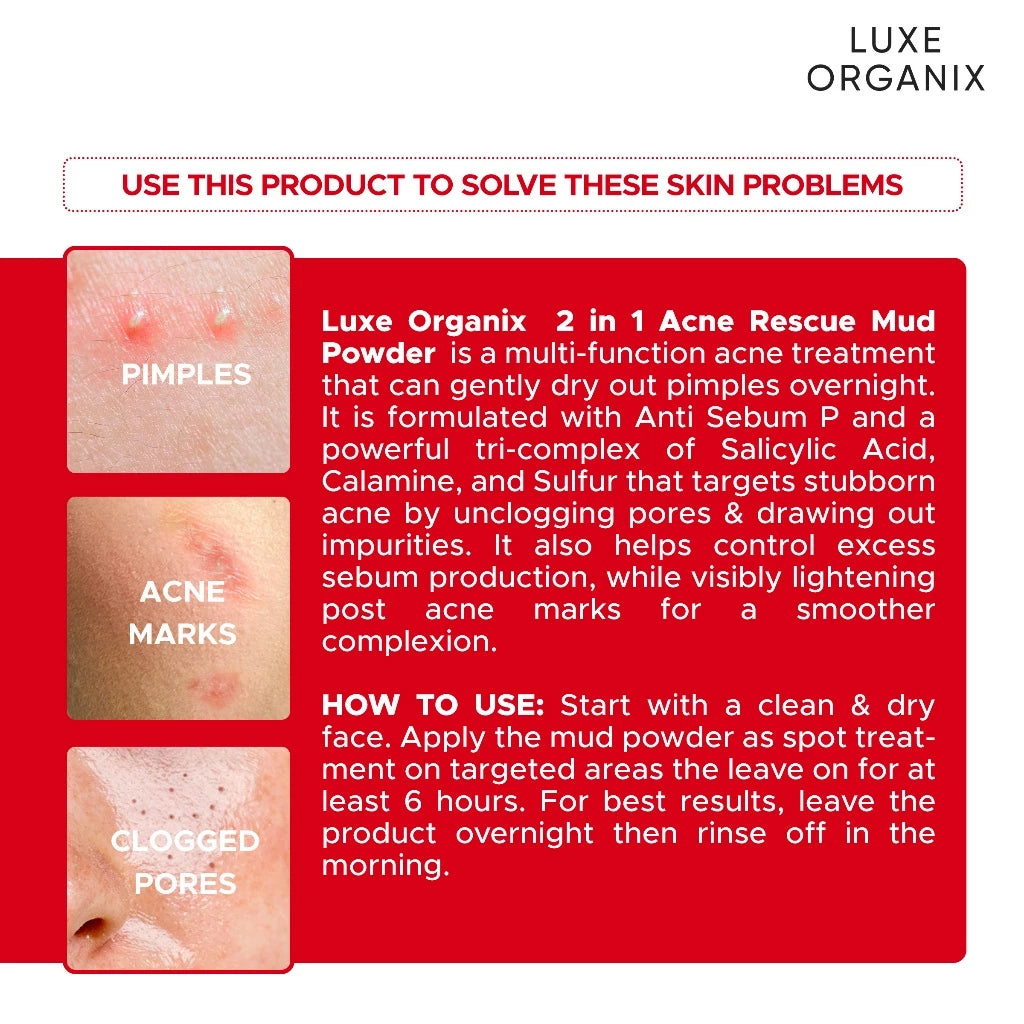 Luxe Organix 2-in-1 Acne Rescue Mud Powder Overnight Pimple Drying