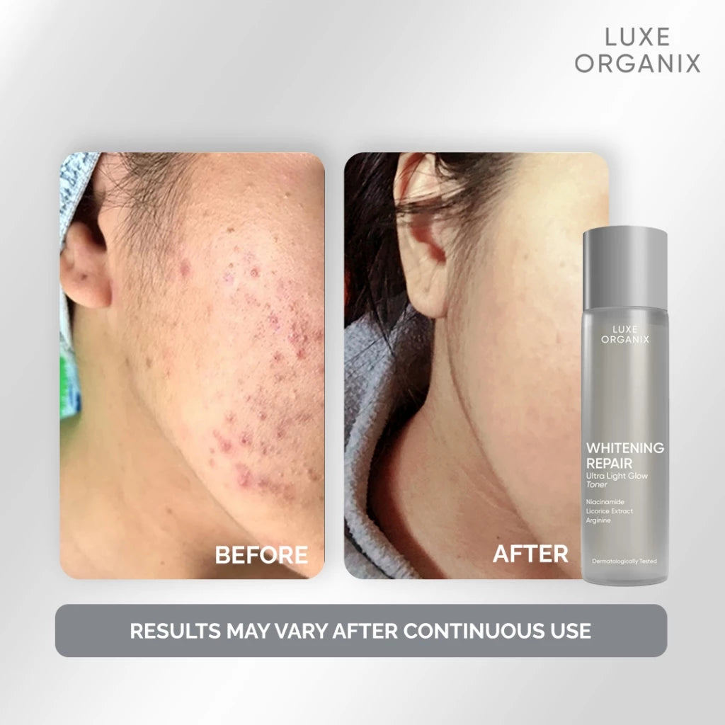 Luxe Organix Whitening Repair Niacinamide Toner 150mL