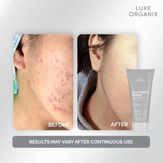 Luxe Organix Whitening Repair Ultralight Glow Foam Cleanser 150g