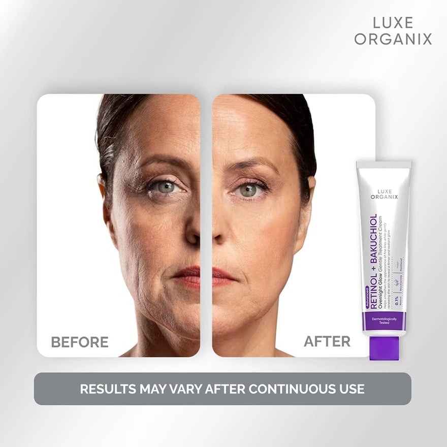 Luxe Organix Retinol + Bakuchiol Overnight Glow Gentle Treatment Cream Moisturizer 30g